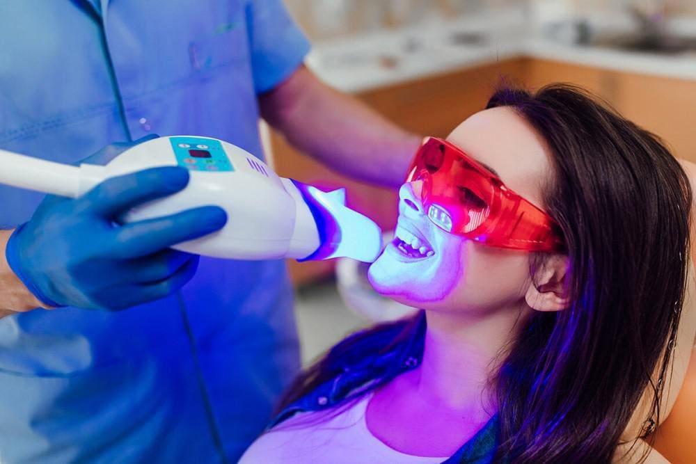 Teeth Whitening in Dubai