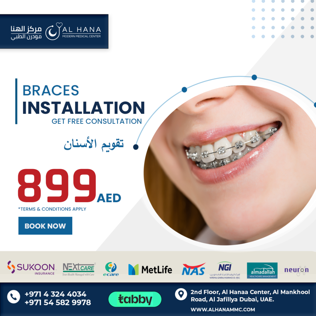 BRACES INSTALLATION - dental offers