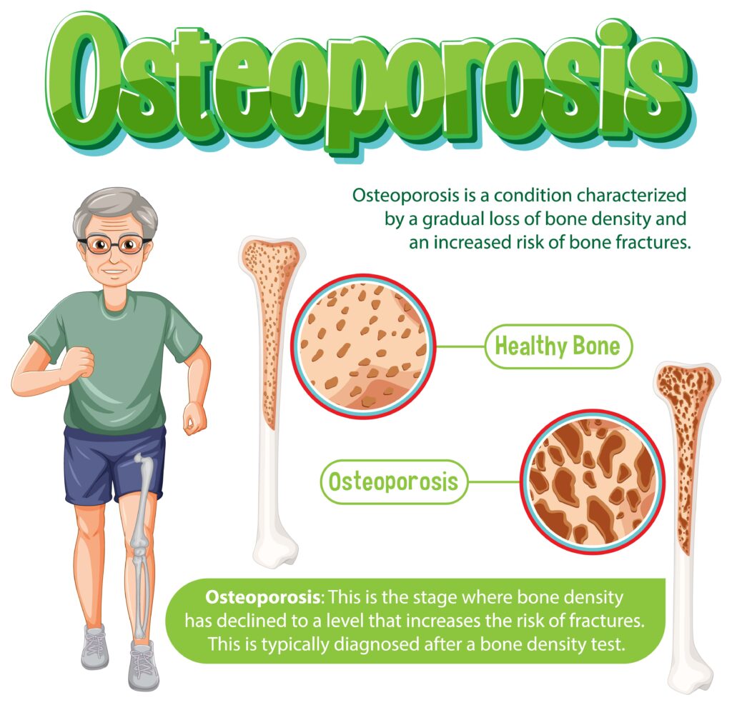 Osteoporosis